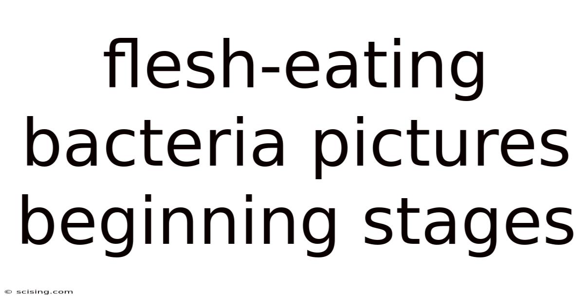 Flesh-eating Bacteria Pictures Beginning Stages