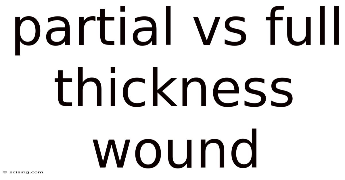 Partial Vs Full Thickness Wound