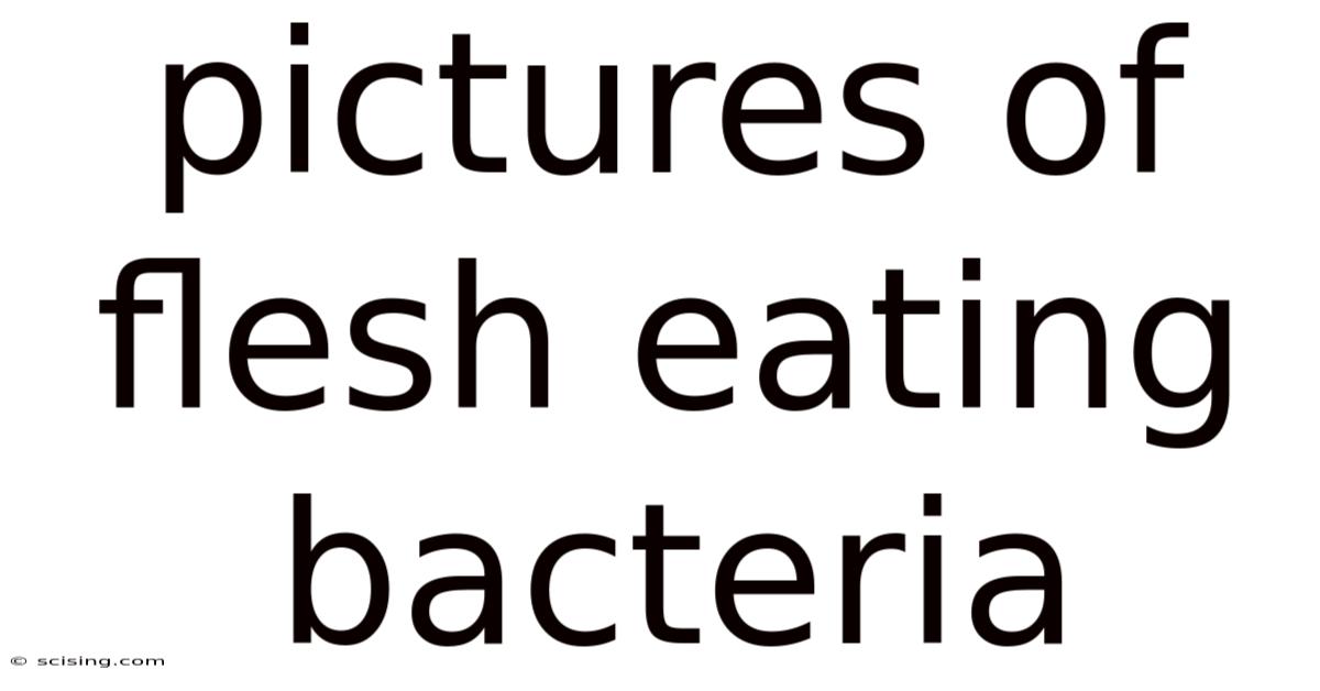 Pictures Of Flesh Eating Bacteria