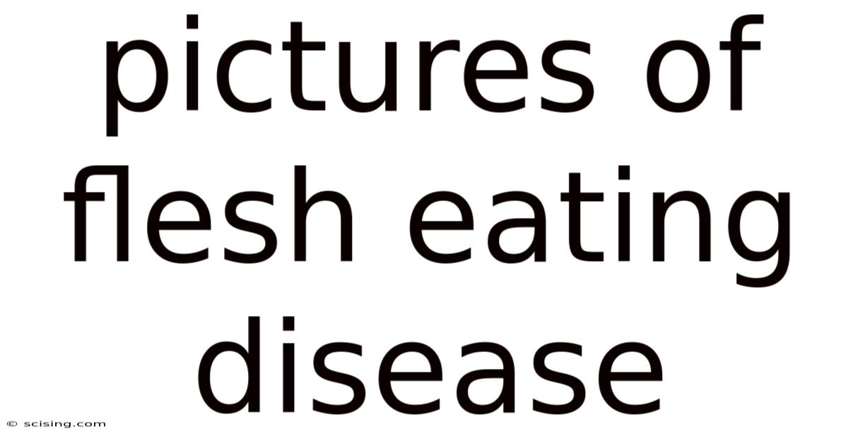 Pictures Of Flesh Eating Disease
