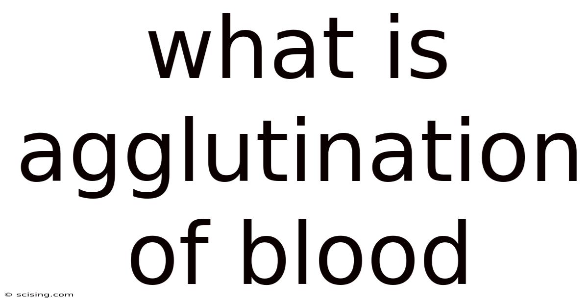 What Is Agglutination Of Blood